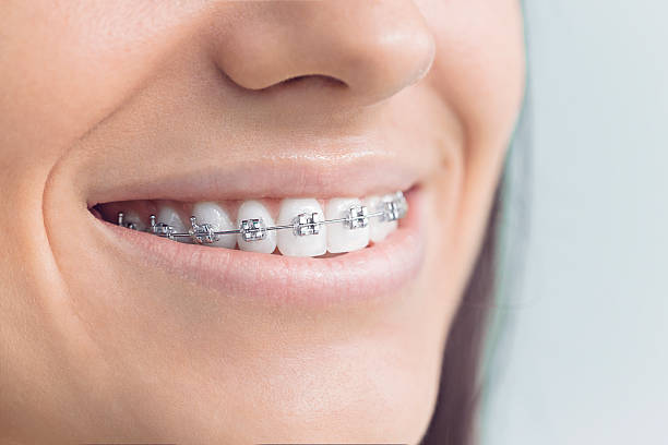 Best Dental Fillings (Composite and Amalgam)  in Marion, TX